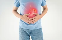 5 lời khuyên giúp ngăn ngừa tình trạng trào ngược axit trong mùa hè