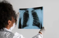 6 thói quen có thể gây hại cho chức năng phổi của bạn ngay cả khi không hút thuốc