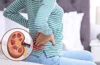 6 mẹo ăn uống bảo vệ thận cho người bệnh tiểu đường