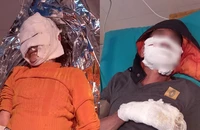 Điện thoại phát nổ khiến 2 vợ chồng bỏng nặng