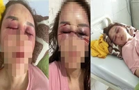 Bắt giam cán bộ QLTT Thanh Hóa đánh đập dã man phụ nữ đơn thân