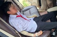 Nổ bóng bay trong lễ khai giảng, 7 học sinh Thanh Hóa bị bỏng tay