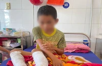 Cha lấy xăng, rơm đốt 2 chân con vì nghe tin con ăn trộm tiền hàng xóm