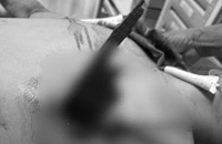 Đi xe máy tông vào hàng rào, nam thanh niên bị thanh gỗ đâm xuyên ngực