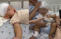 1 người bị bắt vì gây thương tích 46% cho trẻ 14 tháng tuổi