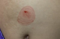 Bé gái 10 tuổi mắc căn bệnh hiếm gặp, 25 năm qua chỉ có 25 ca