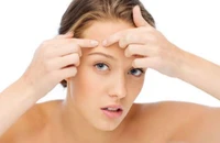 Mụn thịt mọc tại nơi từng nặn mụn rồi lớn dần, có sao không?