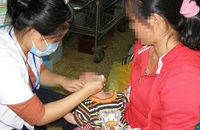Có thể tự mua vitamin A liều cao ở các nhà thuốc không? 