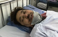 1 người dân tố bị 911 Đà Nẵng đánh vỡ xương mũi