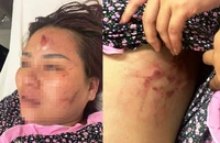 Công an vào cuộc vụ người vợ bị chồng đấm đá dã man, dù đã van xin dừng lại