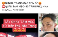 Nữ du khách tẩy chay quán hải sản ở Nha Trang vì chồng bị đánh