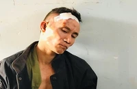 Giám định tâm thần người đấu súng với công an trước cổng trụ sở