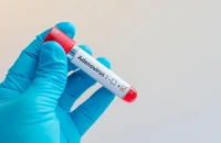 Chuyên gia cảnh báo trẻ mắc Adenovirus, cần bình tĩnh
