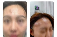 Khởi tố người hành hung bạn gái trong quán cà phê ở Bình Chánh