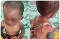 Công an làm rõ vụ bé trai nghi bị bạo hành 