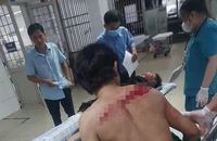 Bình Dương: Nam thanh niên táo tợn dùng dao chém tài xế công nghệ cướp xe máy