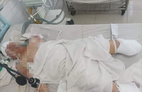 Thương tâm: Người đàn ông đang làm việc thì bị máy trộn bột cuốn vào 