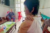 Vợ mang bầu 7 tháng bị chồng ở Hải Dương bạo hành