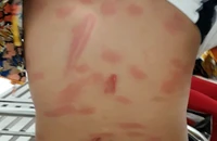 Tạm giữ người cha đánh con gái sáu tuổi bằng khúc sắt