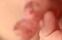 An Giang: Điều tra vụ cha dượng hành hạ dã man con riêng của vợ 