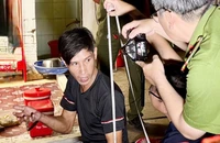 Bạo hành con riêng của 'vợ hờ' chấn thương sọ não