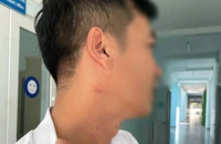 Sẽ buộc thôi việc giáo viên hành hung đồng nghiệp trong sân trường