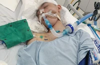 Vụ nam sinh lớp 8 bị đánh chết não: Công an cảnh báo việc đăng tải sai bản chất sự việc