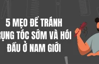 5 mẹo để tránh rụng tóc sớm và hói đầu ở nam giới