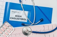 5 thói quen hàng ngày giúp giảm mức cholesterol tự nhiên
