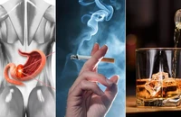 5 thói quen làm tăng nguy cơ mắc ung thư dạ dày