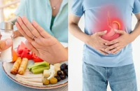 Những thay đổi nhỏ này có thể giúp giảm nguy cơ ung thư dạ dày