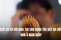 Tuổi 30 và hói đầu: Tại sao rụng tóc xảy ra sớm hơn ở nam giới?