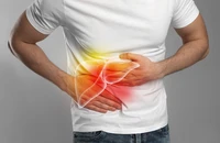 8 dấu hiệu sớm của gan nhiễm mỡ