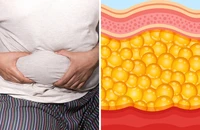 Sự thật đáng lo về mỡ bụng và những nguyên nhân ít ai ngờ 