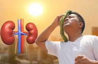 Cơ thể thiếu nước giữa nắng nóng, thận có thể chịu tổn thương nghiêm trọng 