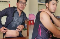 Quảng Trị: 3 người lái máy gặt lúa bị nhóm thanh niên hành hung