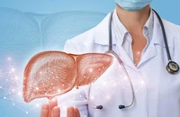 5 loại thực phẩm hại gan hơn bia rượu