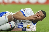 Siêu sao Mbappe không đá trận gặp Hà Lan