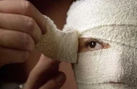 Đua nhau sang Thái du lịch phẩu thuật thẩm mỹ