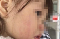 Cô giáo đánh cháu bé 2 tuổi ở Hà Nội bị cho nghỉ việc 