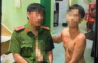 1 Công an ở Tân Bình bị thanh niên nghi ngáo đá tấn công bằng dao