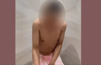 Đổ nước ngọt lên người, vờ bị chích điện để gia đình chuyển tiền cho lừa đảo
