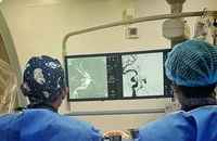Ù tai đỏ mắt suốt 3 tháng, không ngờ bị rò động mạch cảnh