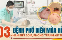 Infographic: Phòng tránh bệnh tay chân miệng, thủy đậu, sốt xuất huyết đang vào mùa