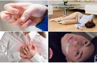 Bệnh động kinh có chữa được không hay phải sống chung suốt đời?