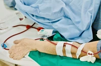 Cảnh báo nguyên nhân bệnh thận mạn tăng ở người trẻ