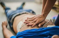 Ngừng tim đột ngột ngày càng tăng ở người trẻ