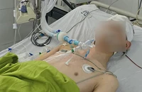 Sức khoẻ nam sinh bị đánh chết não có cải thiện