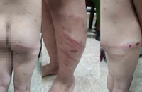 Mẹ ruột và bạn trai bạo hành con trai 11 tuổi