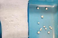 Bé trai 3 tuổi mắc 12 dị vật trong hốc mũi